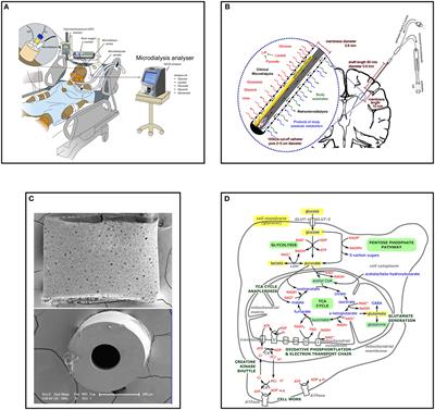 An overview of clinical cerebral microdialysis in acute brain injury